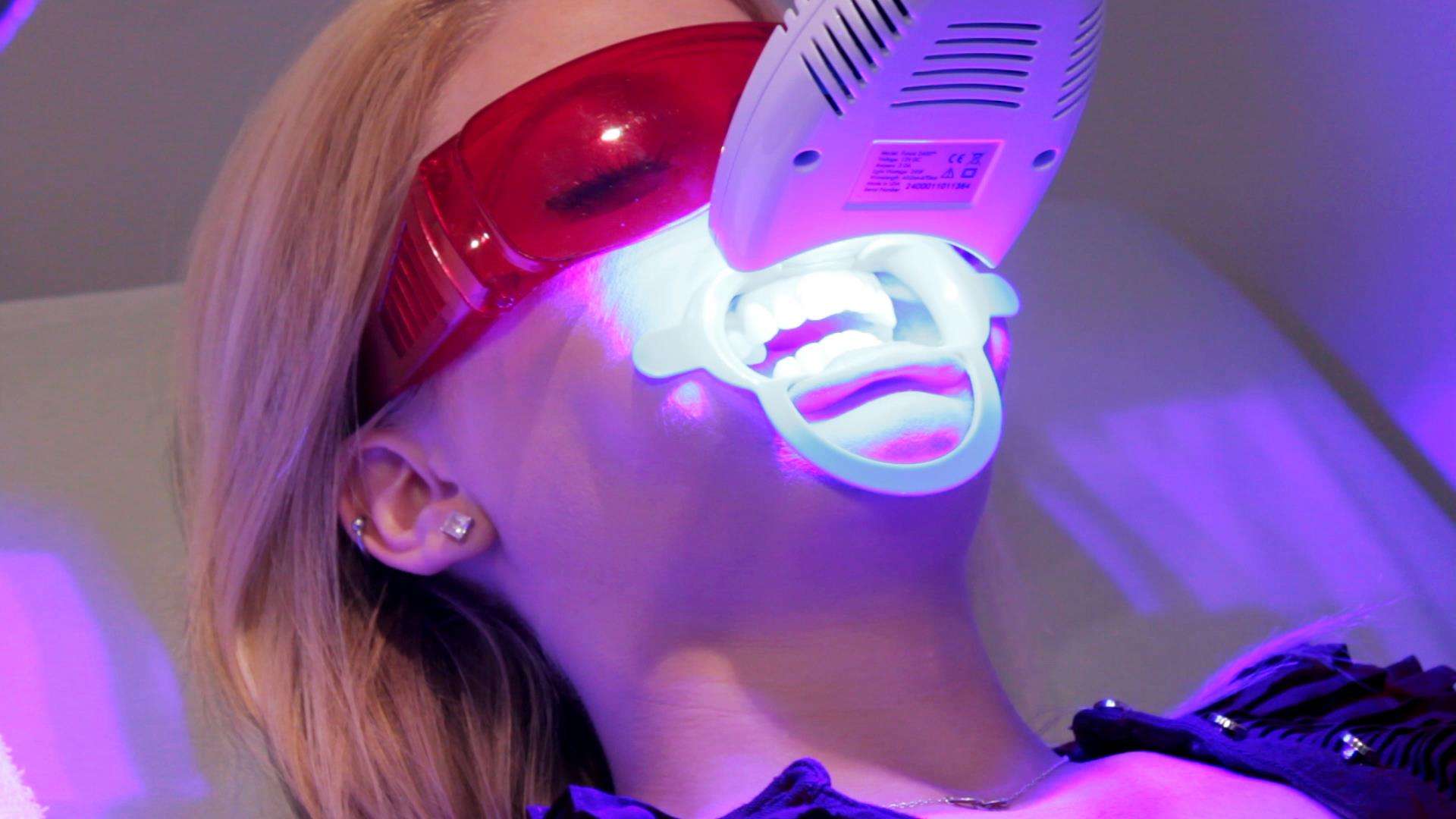 Уф отбеливание зубов. Luma cool отбеливание. Лазерное отбеливание зубов. Ультрафиолетовая лампа для зубов.